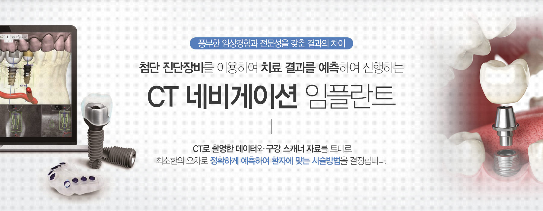 첨단 장비를 이용하여 치료결과를 예측하여 진행하는 CT 네비게이션 임플란트